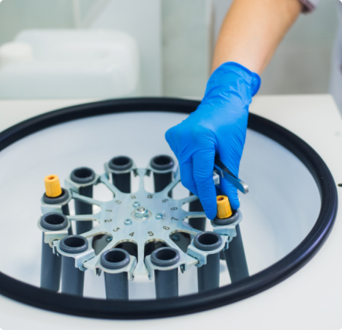 Plättchenreiches Plasma (PRP): Was ist das und wofür wird es verwendet?