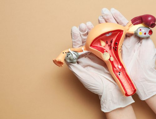 Was ist eine verdickte Gebärmutterschleimhaut oder Endometriumhyperplasie?
